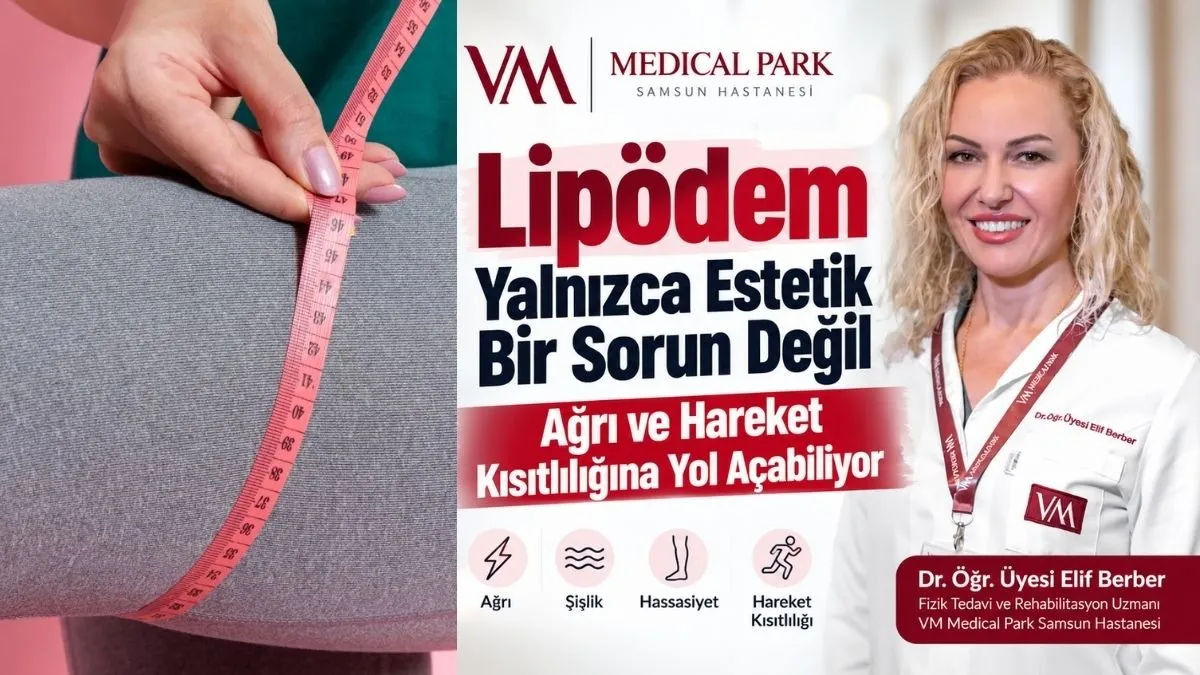 Lipödem Yalnızca Estetik Bir Sorun Değil: Ağrı ve Hareket Kısıtlılığına Yol Açabiliyor